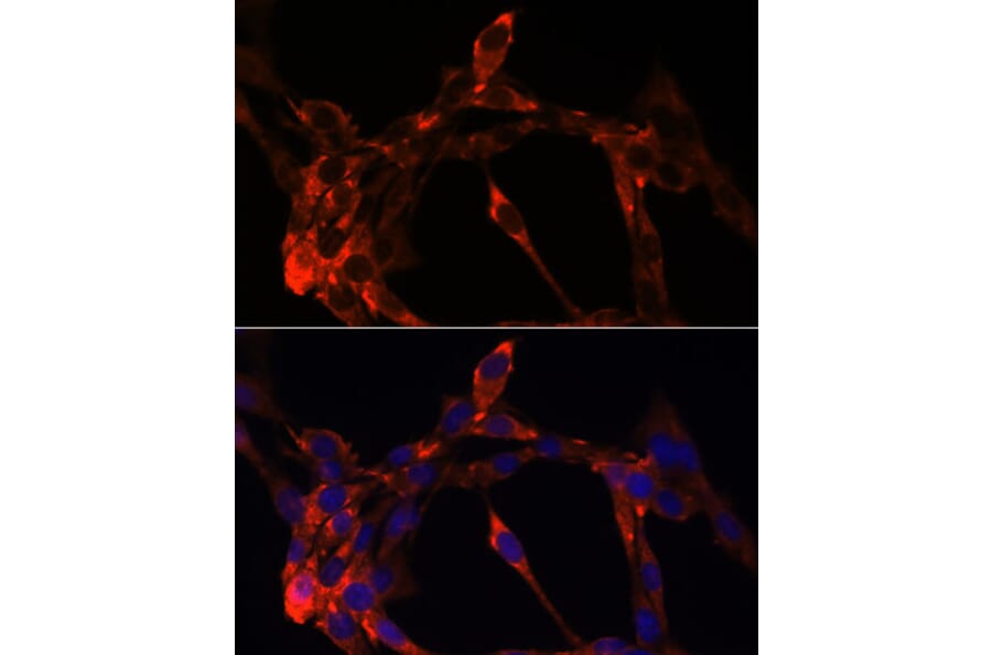 Immunofluorescence - Anti-Jagged1 Antibody (A88414) - Antibodies.com