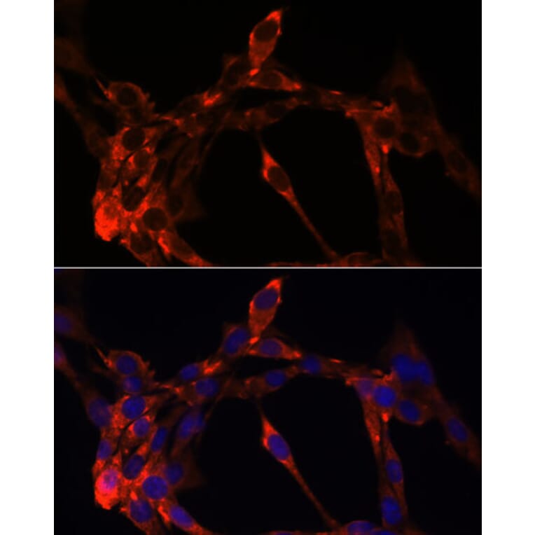 Immunofluorescence - Anti-Jagged1 Antibody (A88414) - Antibodies.com