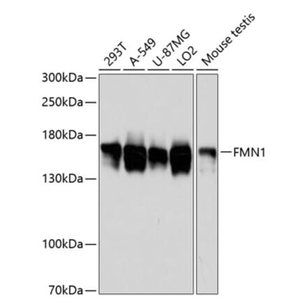 Western Blot - Anti-FMN1 Antibody (A88415) - Antibodies.com