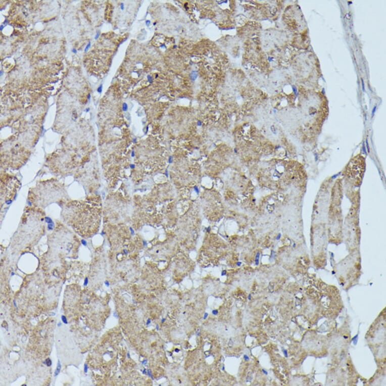 Immunohistochemistry - Anti-Flightless I Antibody (A88416) - Antibodies.com