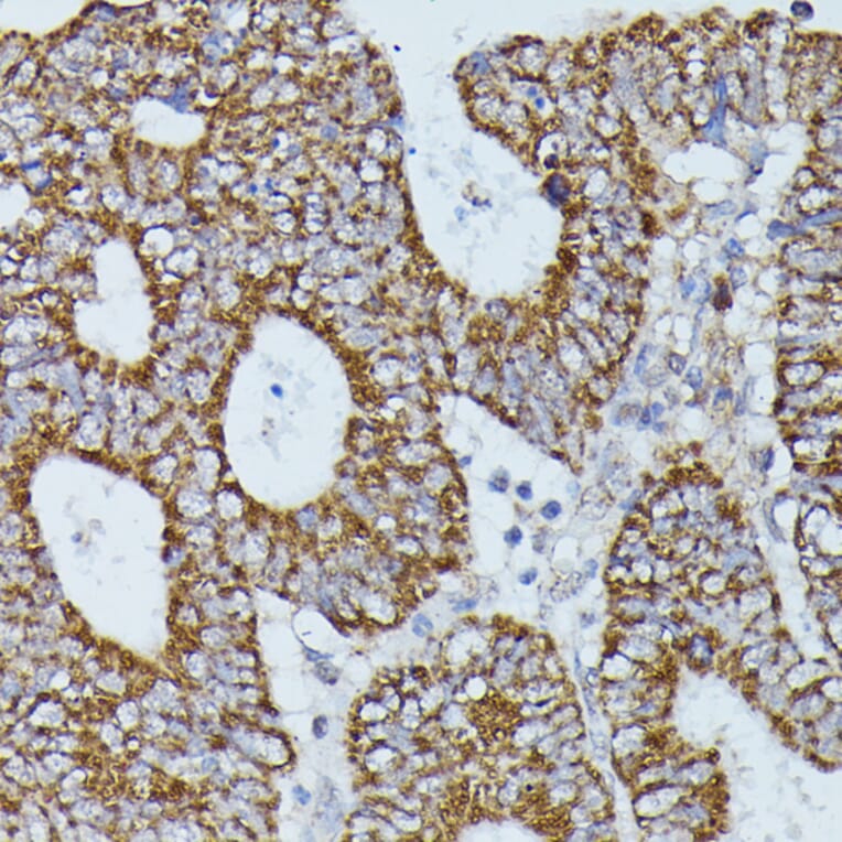 Immunohistochemistry - Anti-Flightless I Antibody (A88416) - Antibodies.com