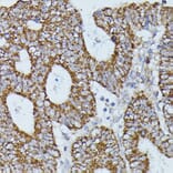 Immunohistochemistry - Anti-Flightless I Antibody (A88416) - Antibodies.com