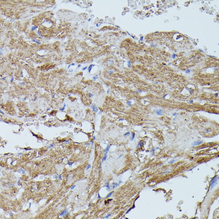 Immunohistochemistry - Anti-Flightless I Antibody (A88416) - Antibodies.com