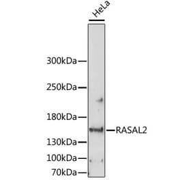 Western Blot - Anti-RASAL2 Antibody (A88417) - Antibodies.com