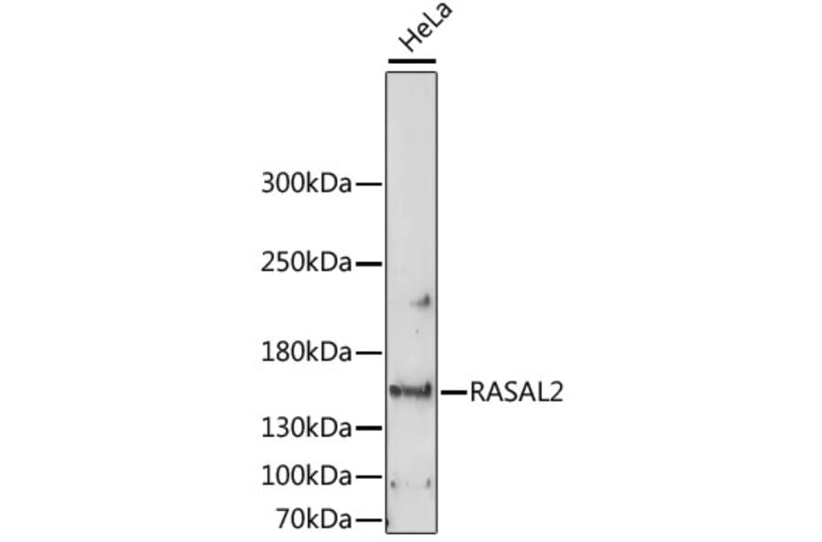 Western Blot - Anti-RASAL2 Antibody (A88417) - Antibodies.com