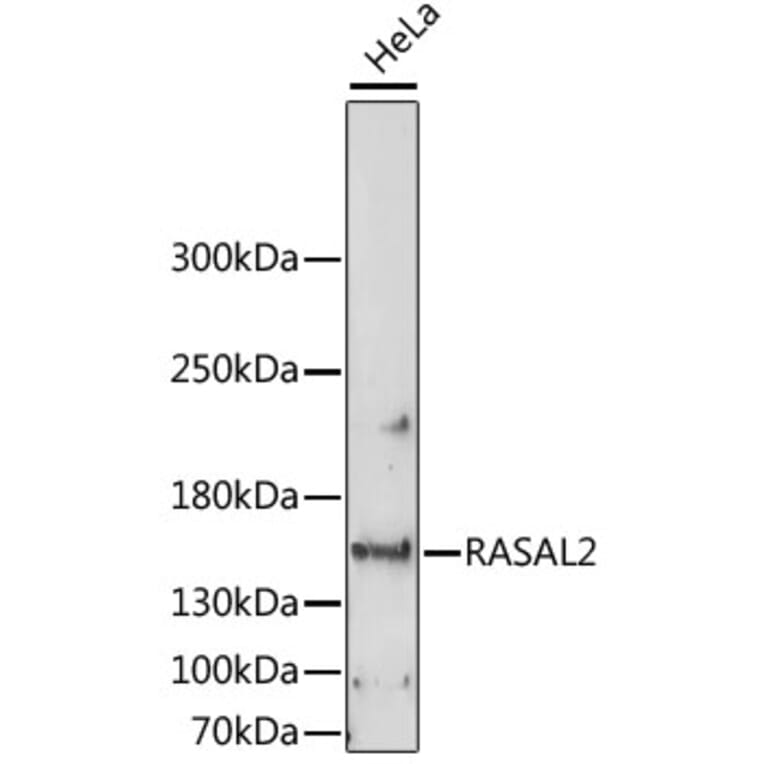 Western Blot - Anti-RASAL2 Antibody (A88417) - Antibodies.com