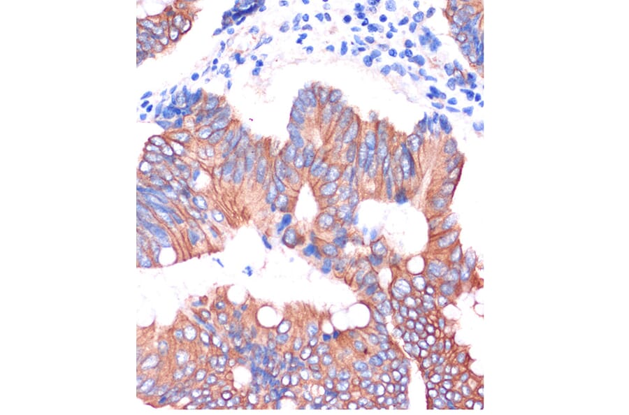 Immunohistochemistry - Anti-Cingulin Antibody (A88418) - Antibodies.com