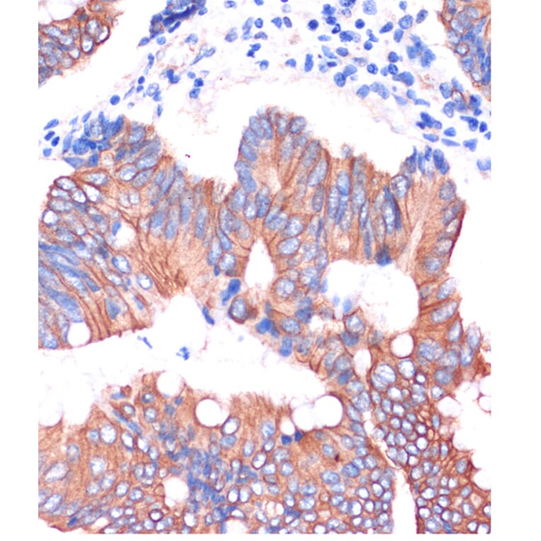 Immunohistochemistry - Anti-Cingulin Antibody (A88418) - Antibodies.com