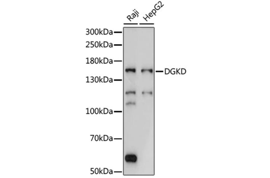 Western Blot - Anti-DGKD Antibody (A88419) - Antibodies.com