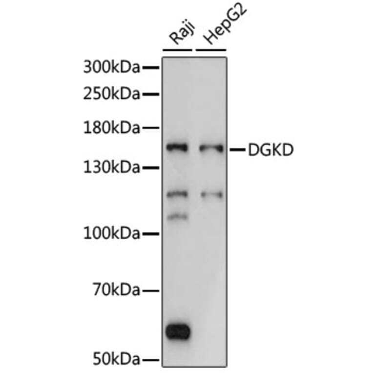 Western Blot - Anti-DGKD Antibody (A88419) - Antibodies.com