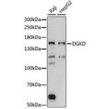 Western Blot - Anti-DGKD Antibody (A88419) - Antibodies.com