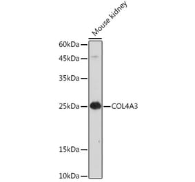 Western Blot - Anti-COL4A3 Antibody (A88421) - Antibodies.com