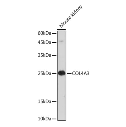 Western Blot - Anti-COL4A3 Antibody (A88421) - Antibodies.com