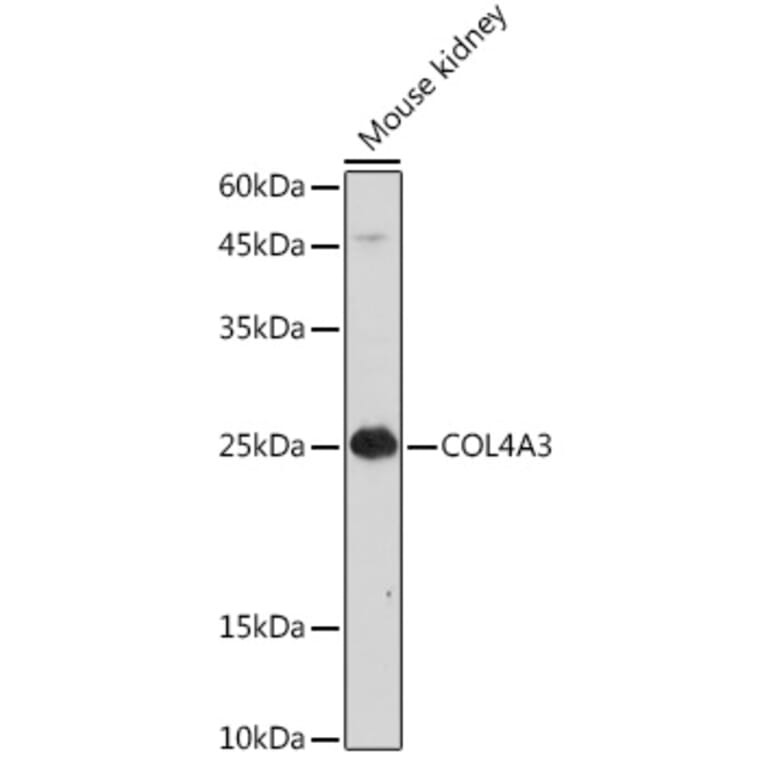 Western Blot - Anti-COL4A3 Antibody (A88421) - Antibodies.com
