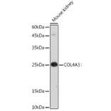 Western Blot - Anti-COL4A3 Antibody (A88421) - Antibodies.com