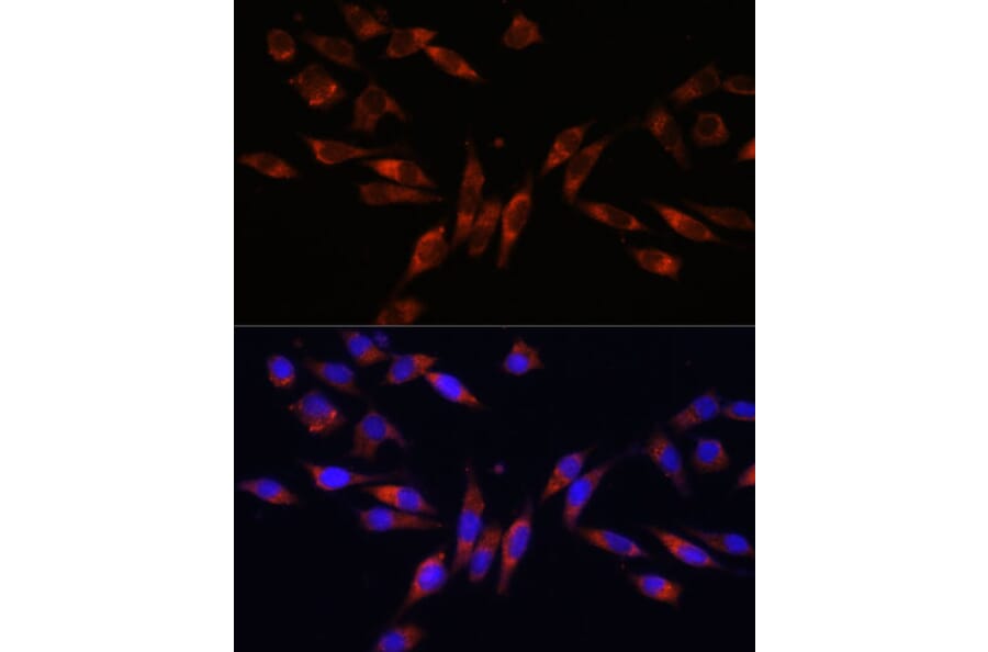 Immunofluorescence - Anti-COL4A3 Antibody (A88421) - Antibodies.com