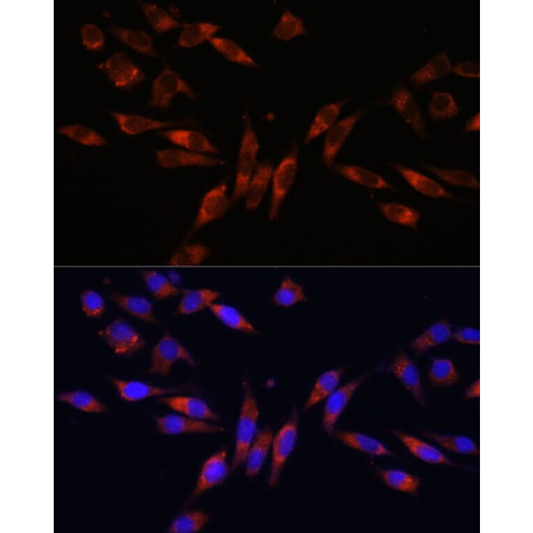 Immunofluorescence - Anti-COL4A3 Antibody (A88421) - Antibodies.com