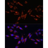 Immunofluorescence - Anti-COL4A3 Antibody (A88421) - Antibodies.com