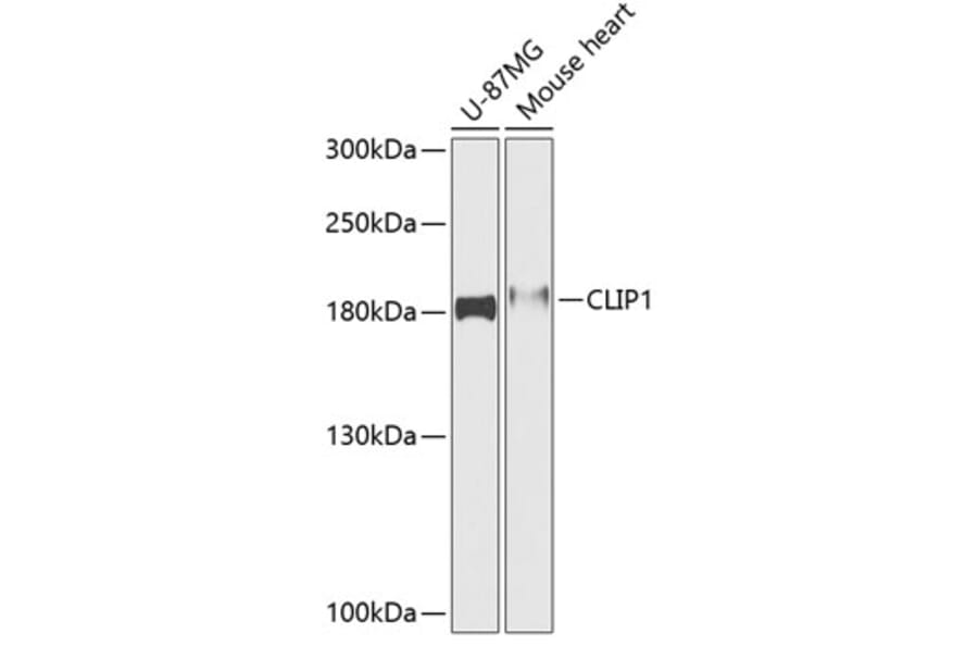 Western Blot - Anti-CLIP170 Antibody (A88422) - Antibodies.com