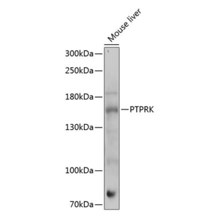 Western Blot - Anti-PTPRK Antibody (A88423) - Antibodies.com