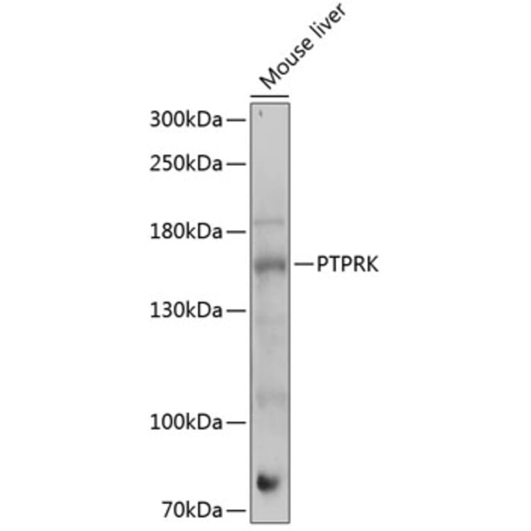 Western Blot - Anti-PTPRK Antibody (A88423) - Antibodies.com