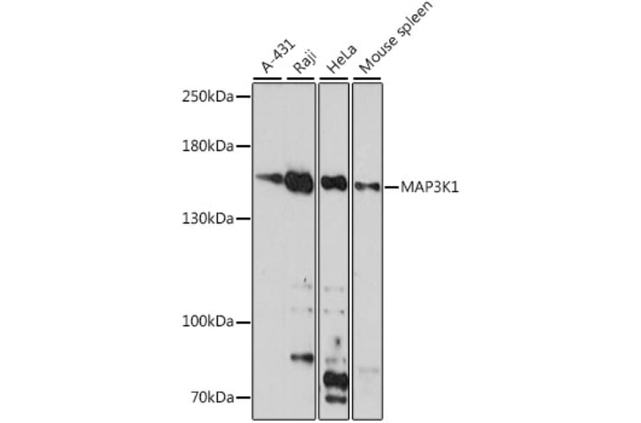 Western Blot - Anti-MAP3K1 Antibody (A88425) - Antibodies.com