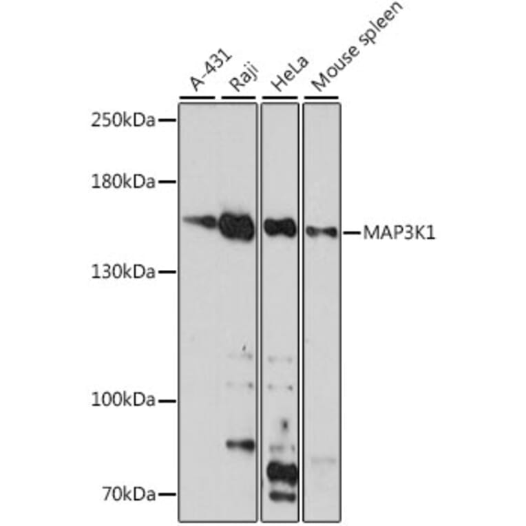 Western Blot - Anti-MAP3K1 Antibody (A88425) - Antibodies.com