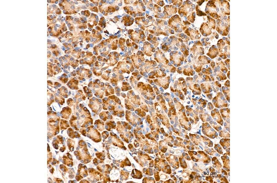 Immunohistochemistry - Anti-MAP3K1 Antibody (A88425) - Antibodies.com