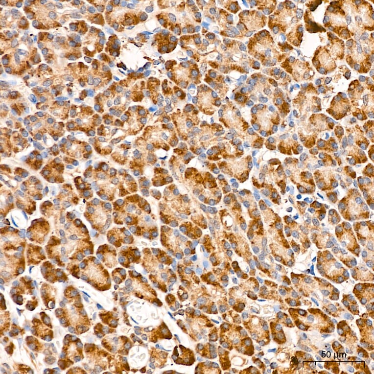 Immunohistochemistry - Anti-MAP3K1 Antibody (A88425) - Antibodies.com