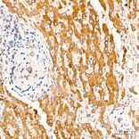 Immunohistochemistry - Anti-MAP3K1 Antibody (A88425) - Antibodies.com