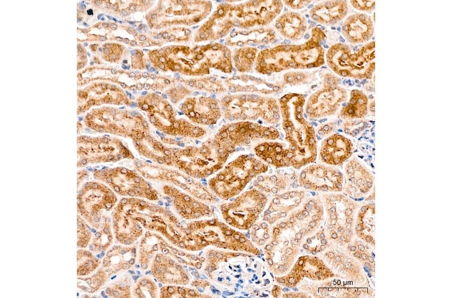 Immunohistochemistry - Anti-MAP3K1 Antibody (A88425) - Antibodies.com