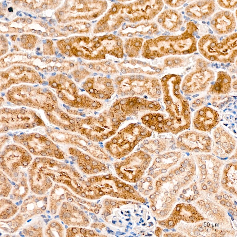Immunohistochemistry - Anti-MAP3K1 Antibody (A88425) - Antibodies.com
