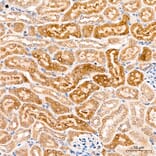 Immunohistochemistry - Anti-MAP3K1 Antibody (A88425) - Antibodies.com