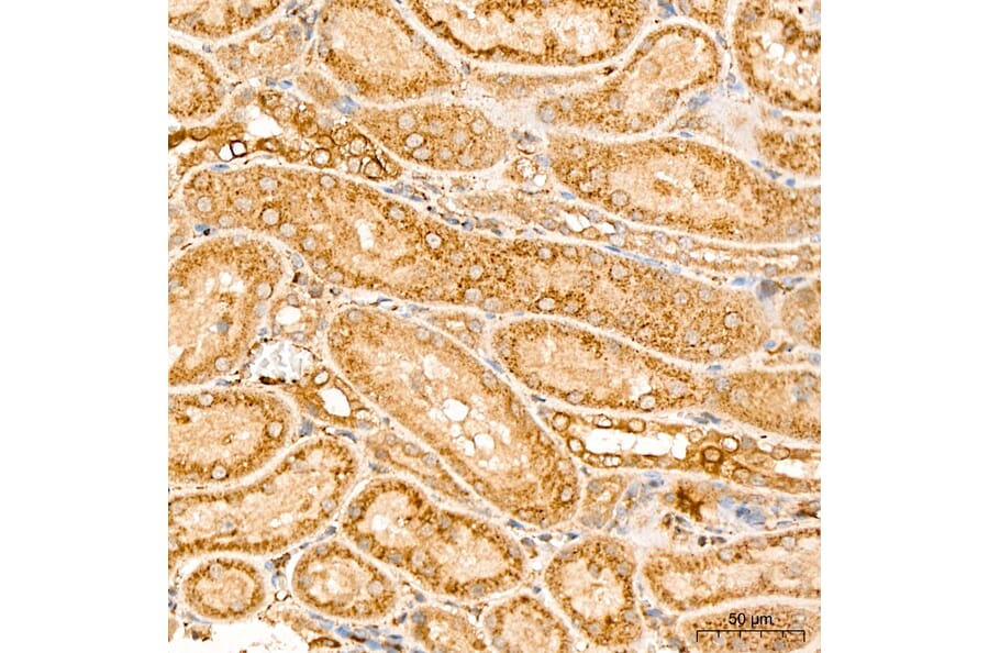Immunohistochemistry - Anti-MAP3K1 Antibody (A88425) - Antibodies.com