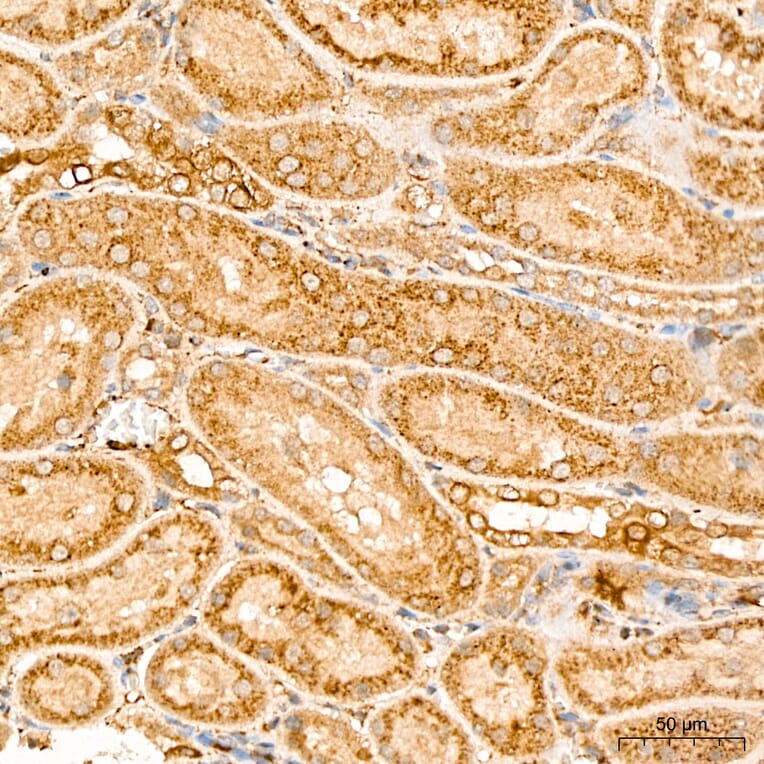 Immunohistochemistry - Anti-MAP3K1 Antibody (A88425) - Antibodies.com