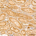 Immunohistochemistry - Anti-MAP3K1 Antibody (A88425) - Antibodies.com