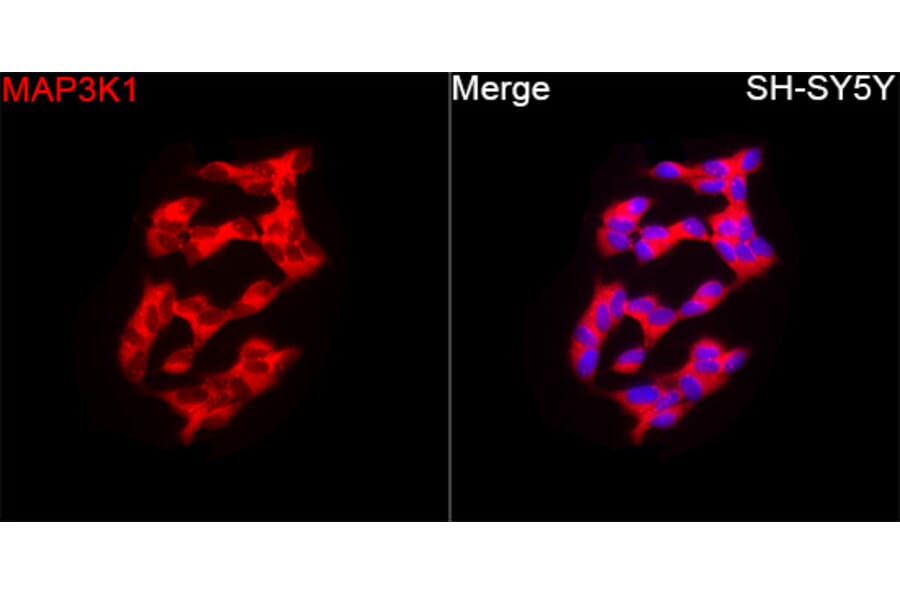 Immunofluorescence - Anti-MAP3K1 Antibody (A88425) - Antibodies.com