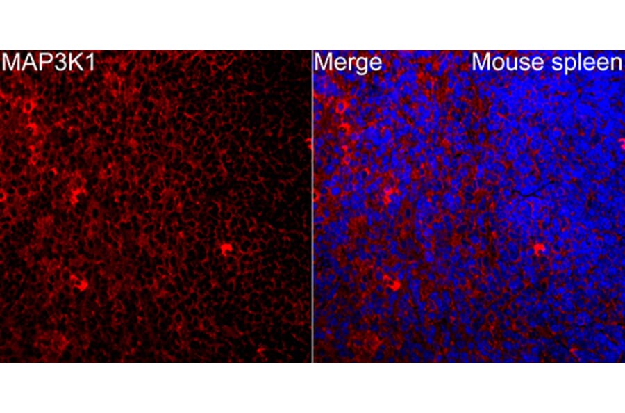 Immunofluorescence - Anti-MAP3K1 Antibody (A88425) - Antibodies.com