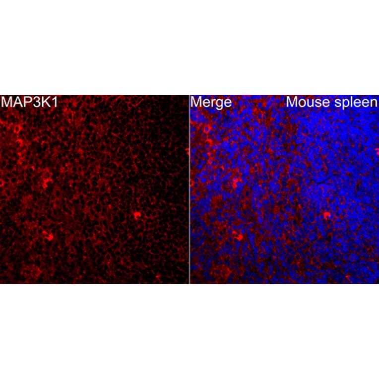 Immunofluorescence - Anti-MAP3K1 Antibody (A88425) - Antibodies.com