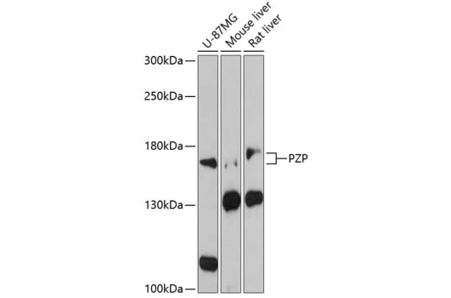 Western Blot - Anti-PZP Antibody (A88427) - Antibodies.com
