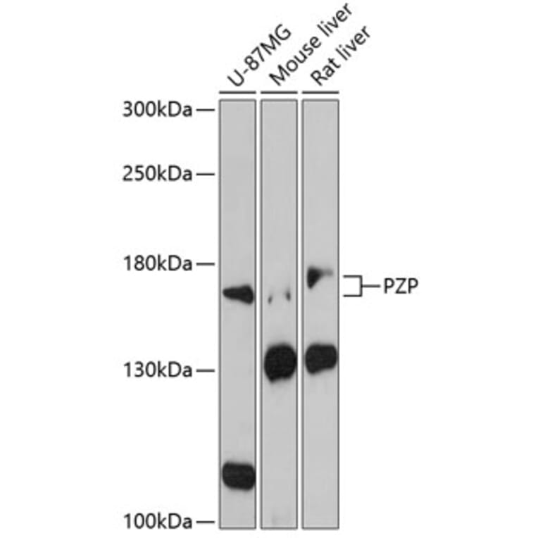 Western Blot - Anti-PZP Antibody (A88427) - Antibodies.com