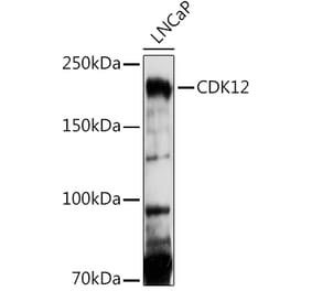 Western Blot - Anti-CDK12 Antibody (A88428) - Antibodies.com