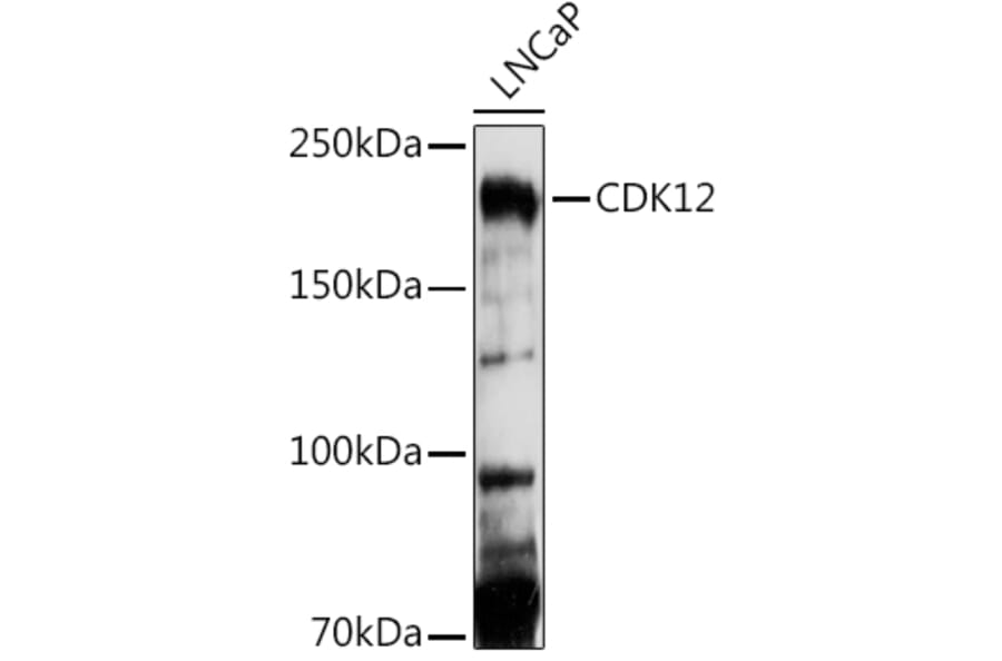 Western Blot - Anti-CDK12 Antibody (A88428) - Antibodies.com