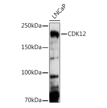 Western Blot - Anti-CDK12 Antibody (A88428) - Antibodies.com