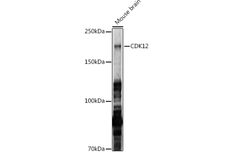 Western Blot - Anti-CDK12 Antibody (A88428) - Antibodies.com