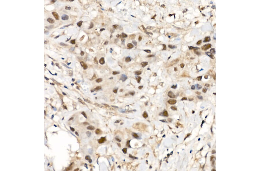 Immunohistochemistry - Anti-CDK12 Antibody (A88428) - Antibodies.com