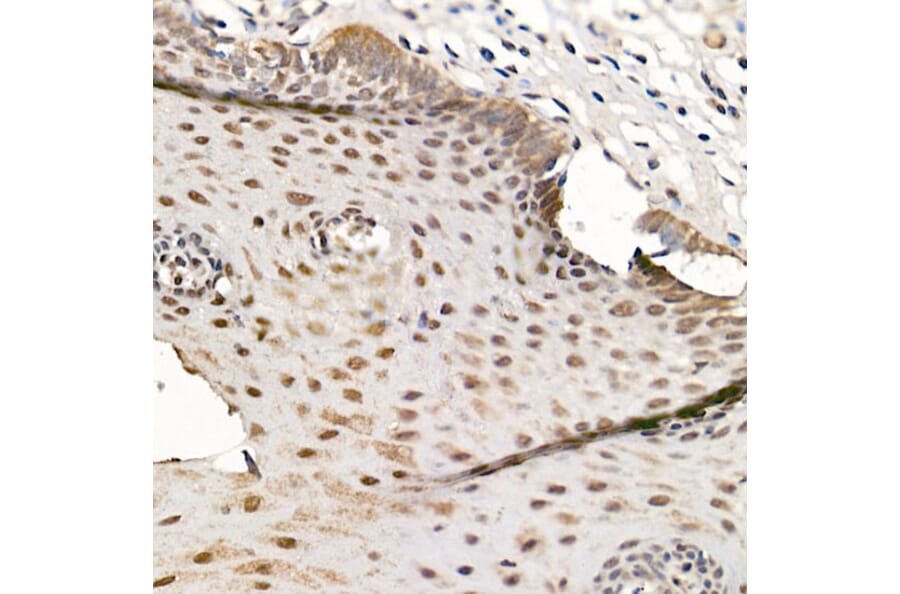 Immunohistochemistry - Anti-CDK12 Antibody (A88428) - Antibodies.com