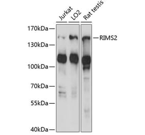 Western Blot - Anti-RIM2 Antibody (A88429) - Antibodies.com