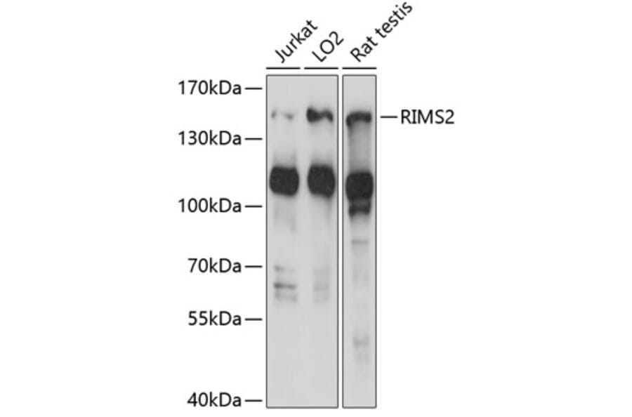 Western Blot - Anti-RIM2 Antibody (A88429) - Antibodies.com