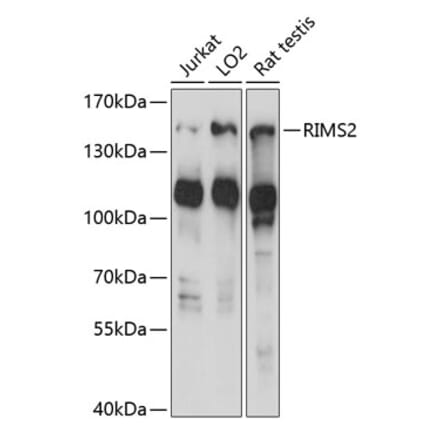 Western Blot - Anti-RIM2 Antibody (A88429) - Antibodies.com
